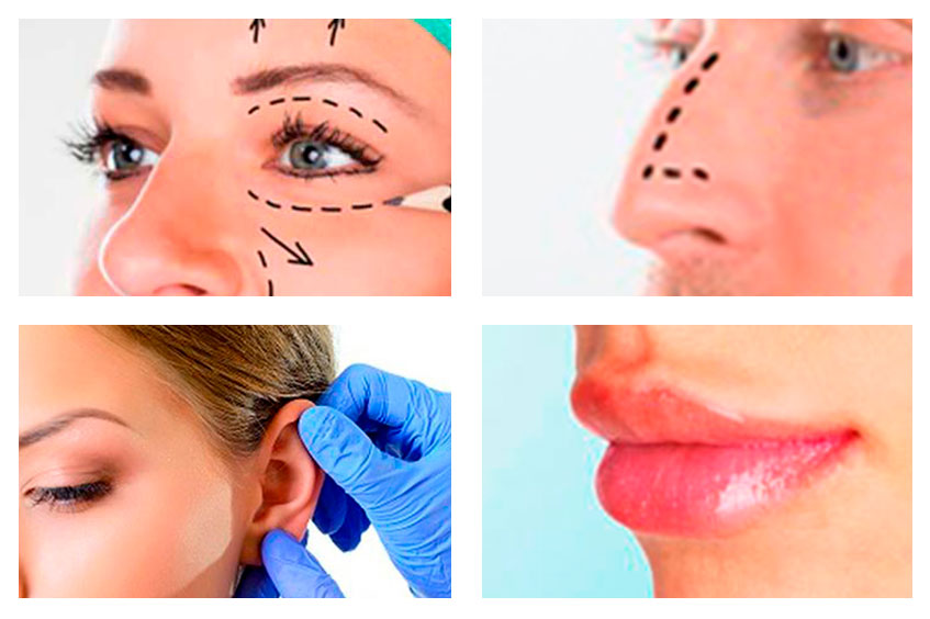 4 buenas razones para someterte a una cirugía estética facial